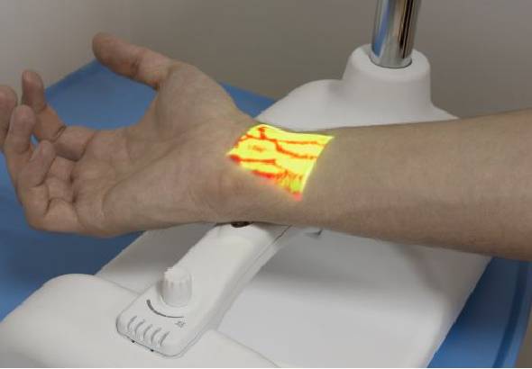 Iluminator żył
